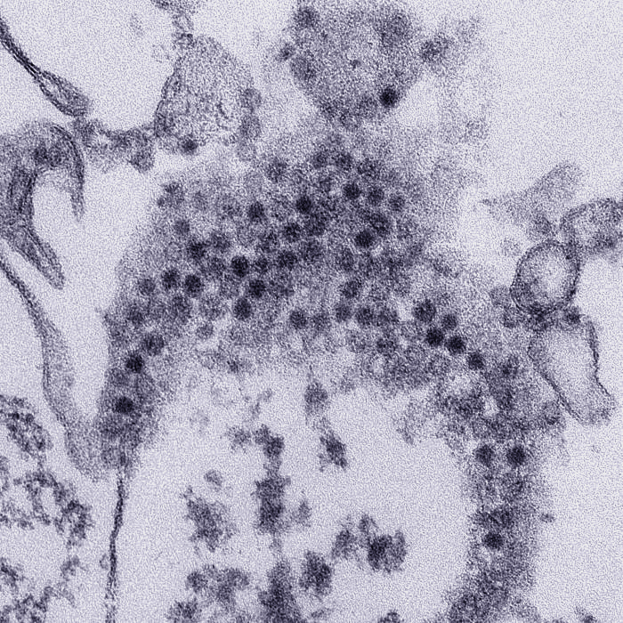 Transmission electron microscope image of EV-D68 virions Electron microscope image revealing numerous, spheroid shaped EV-D68 virions