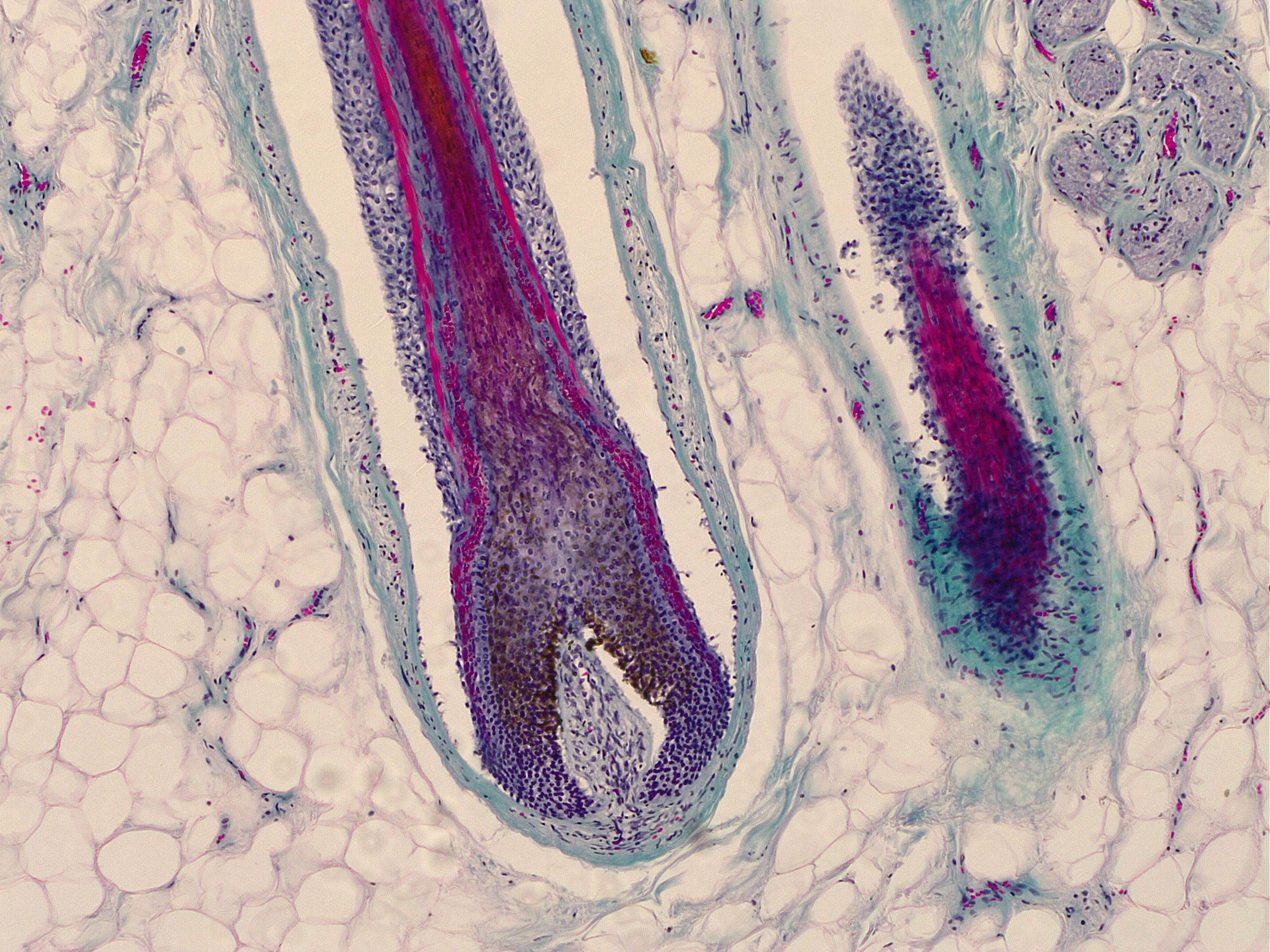 Microscope image of a hair follicle in human skin