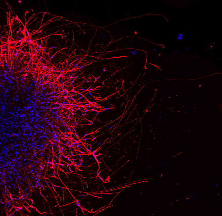 Neurons growing neurites