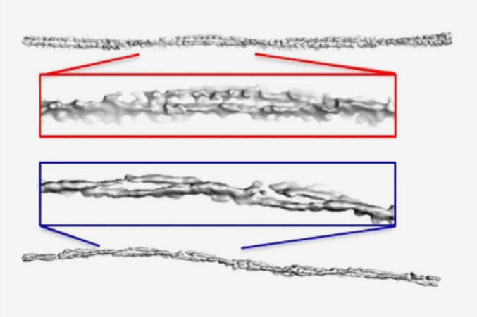 Alpha-synuclein fibrils Alpha-synuclein fibrils from people with PD and MSA show different levels of twisting.