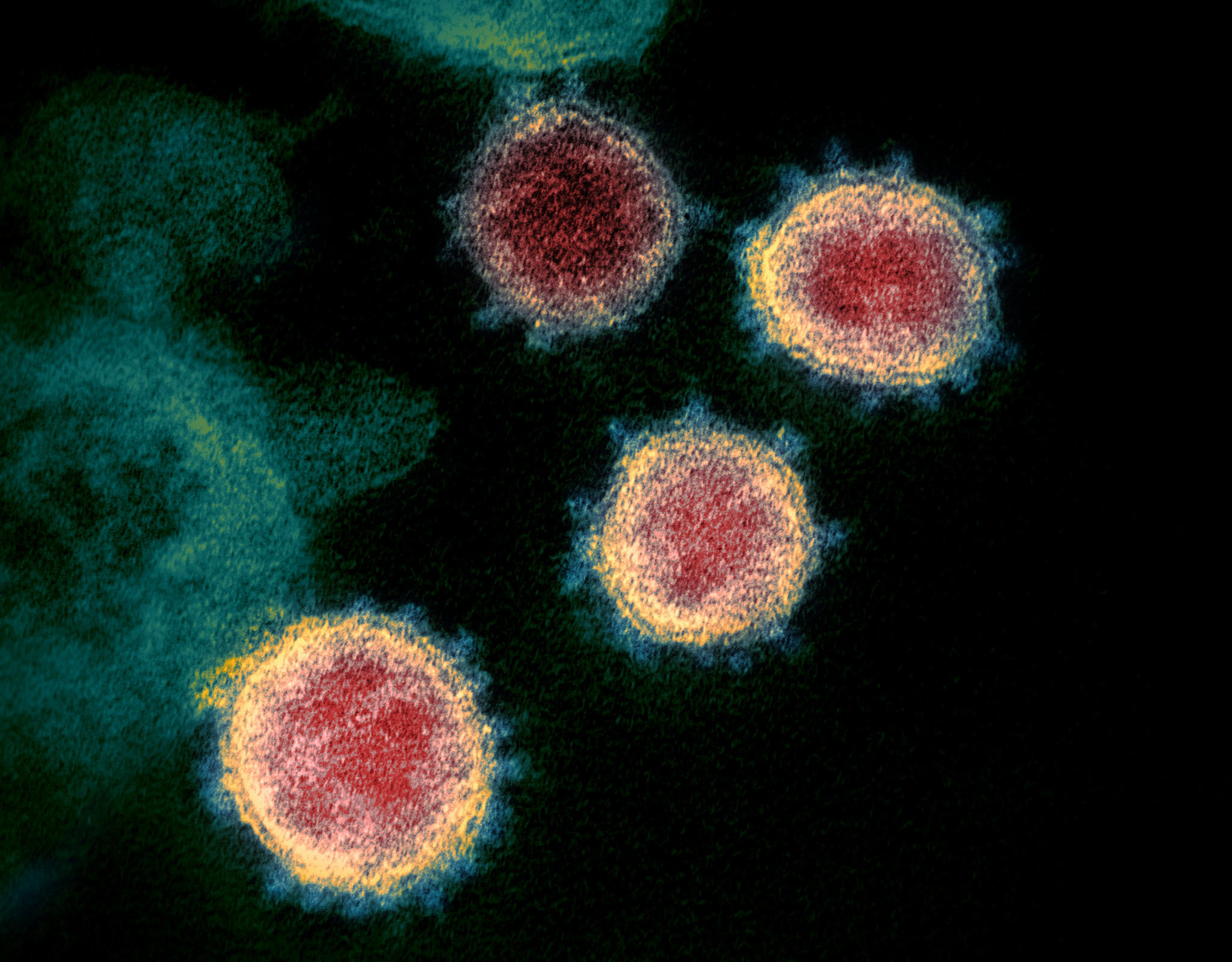 Novel coronavirus structure reveals targets for vaccines ...