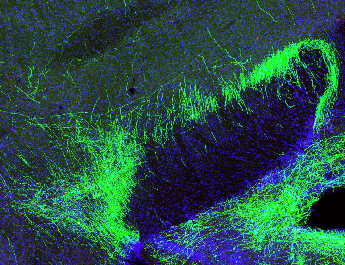 Pain suppression neurons in mouse brain. Pain suppression neurons in mouse brain.