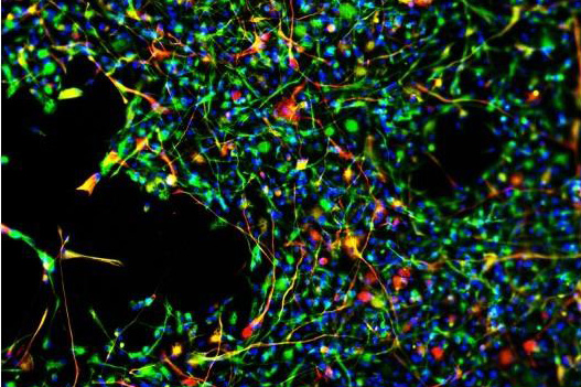 Fluorescent microscope image of neural stem cells maturing Fluorescent microscope image of neural stem cells maturing
