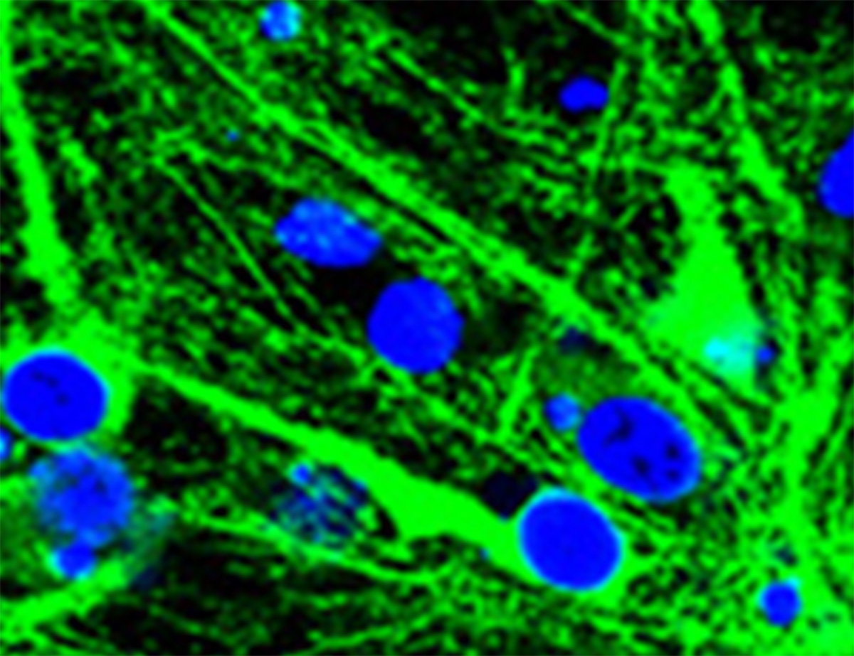 Immunofluorescence images of tau in neurons 