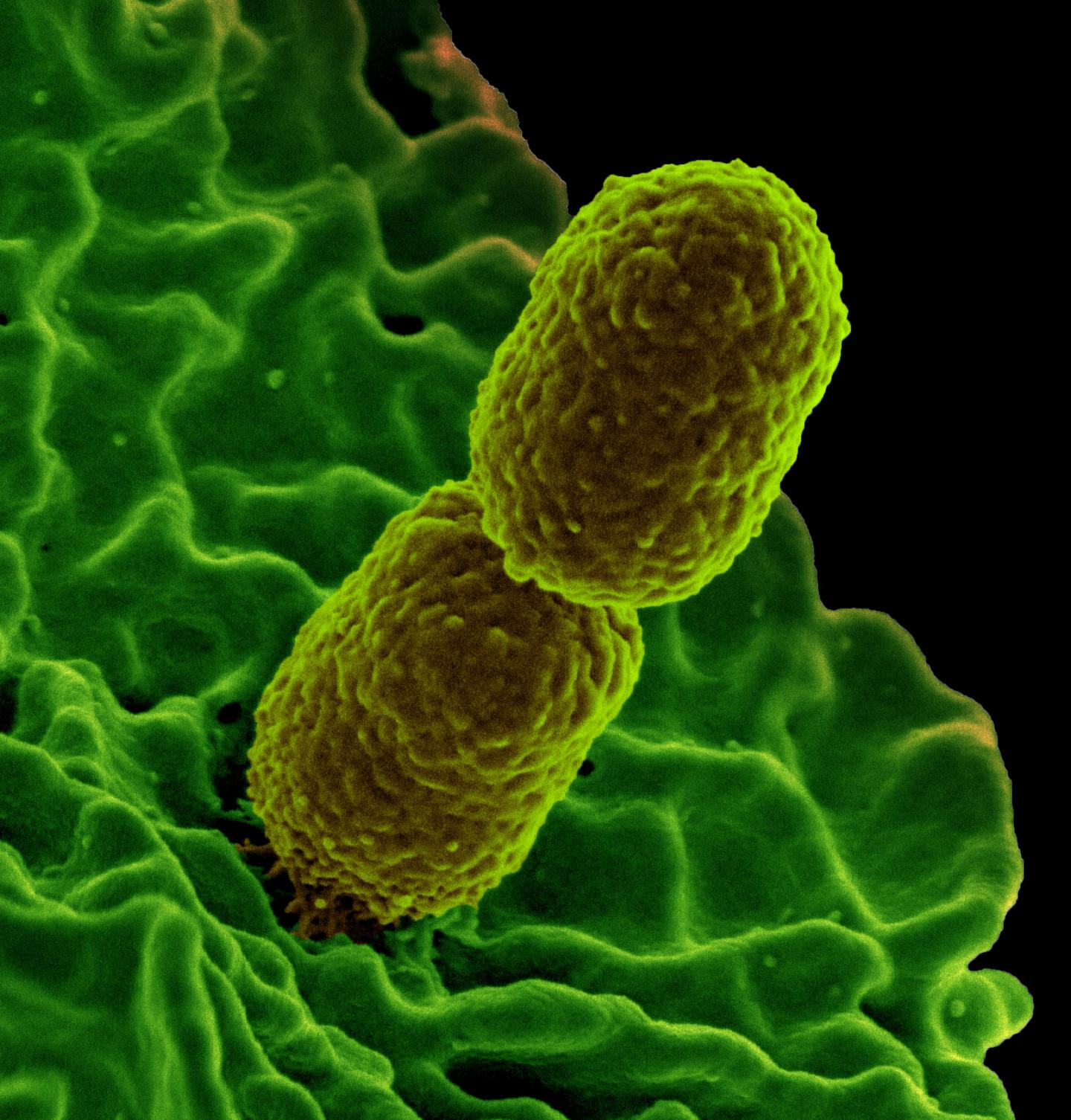 Klebsiella pneumoniae on surface of human neutrophil