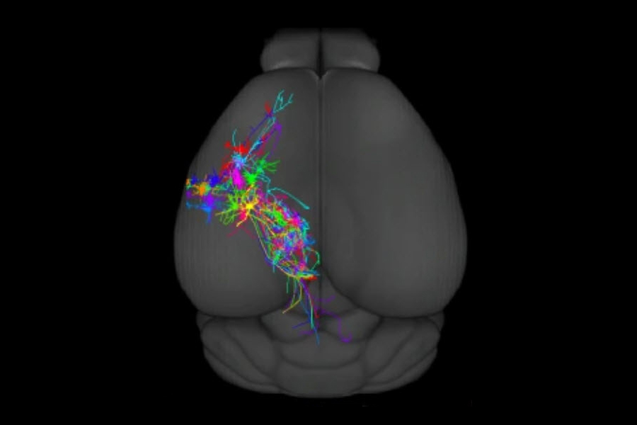 Neurons depicted in different colors that spread across the brain