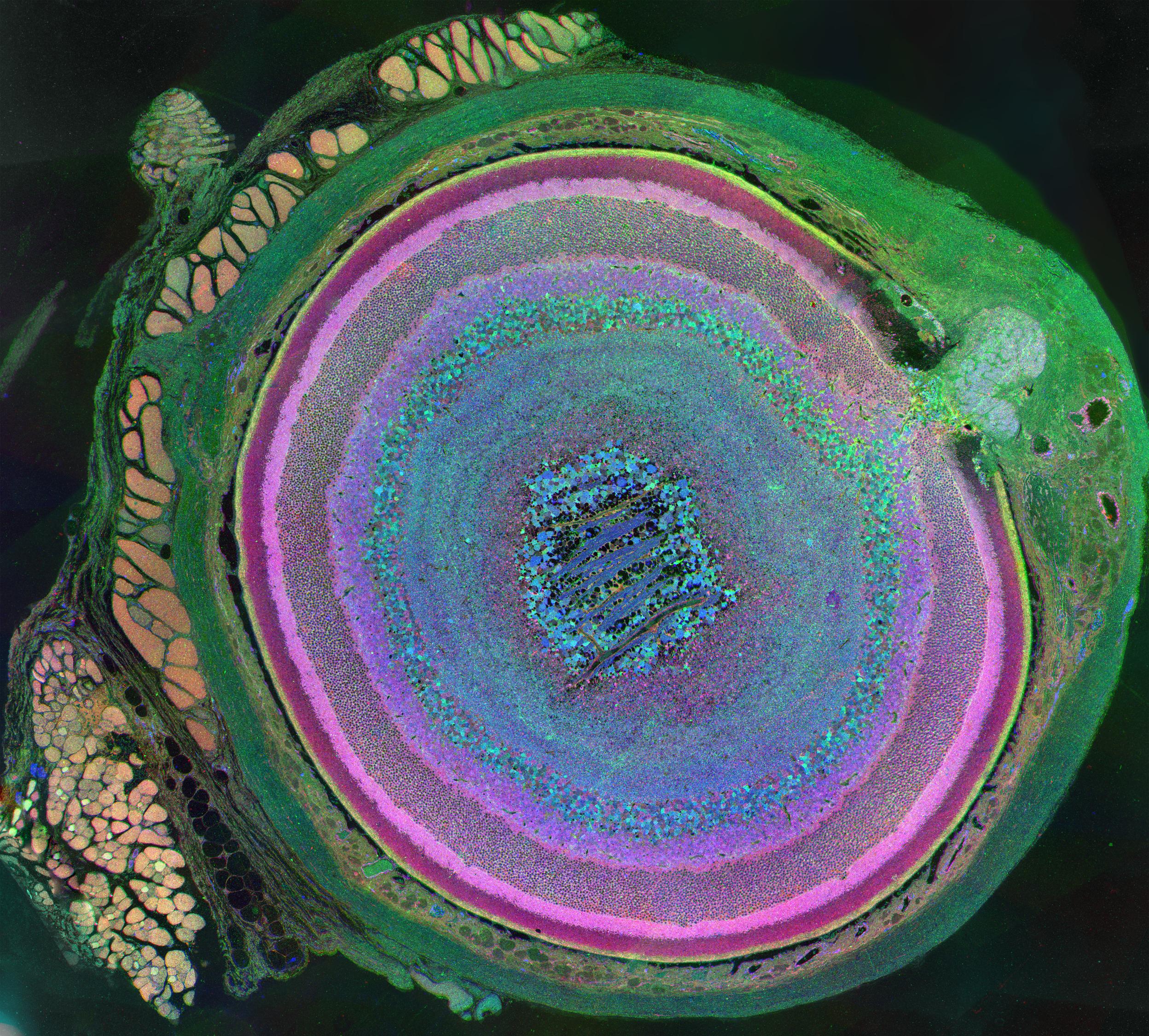 Photograph of retina Photograph of retina
