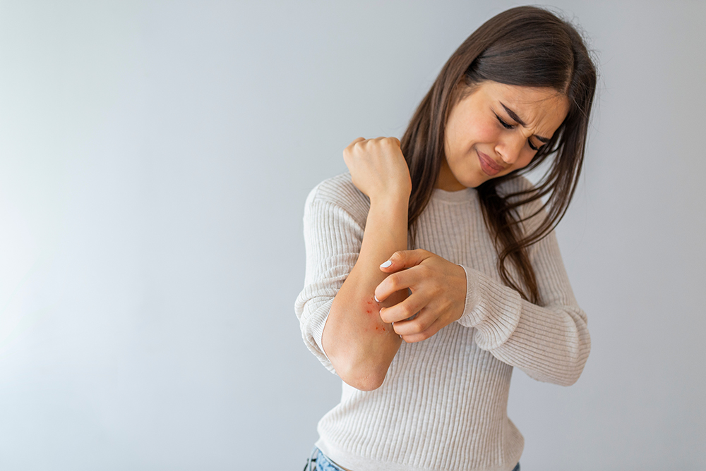 Woman scratching her arm