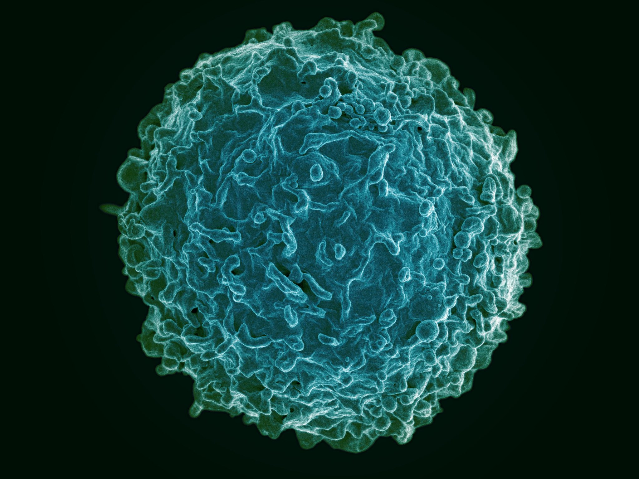 Colorized scanning electron micrograph of a B cell