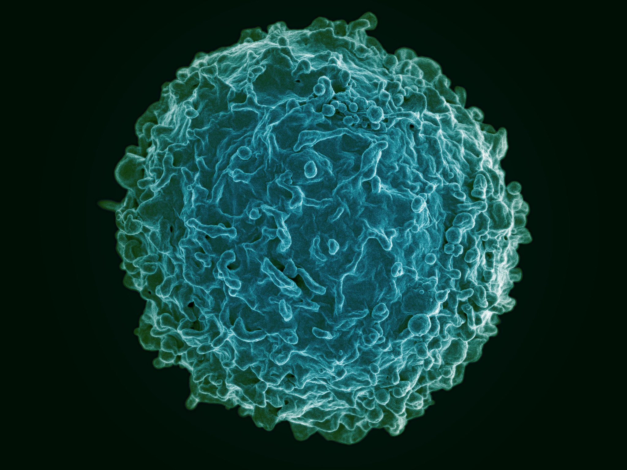 Colorized scanning electron micrograph of a B cell Colorized scanning electron micrograph of a B cell