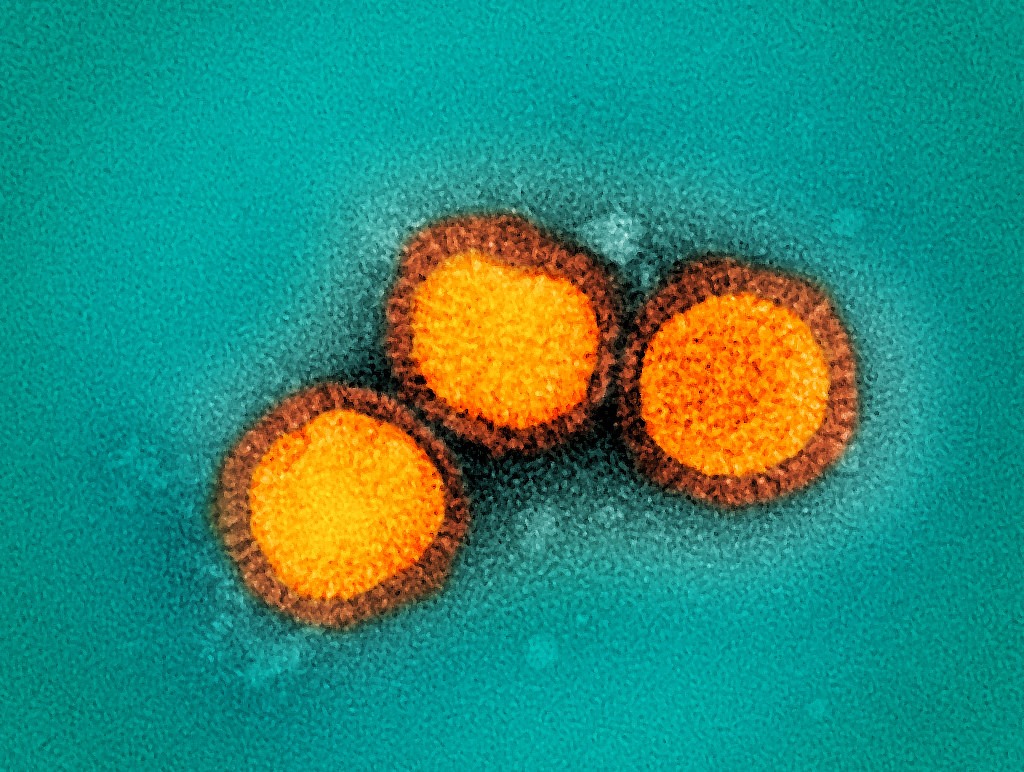 Colorized electron micrograph of three round virus particles