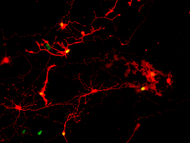 Retinal neurons glowing red, some with green nuclei