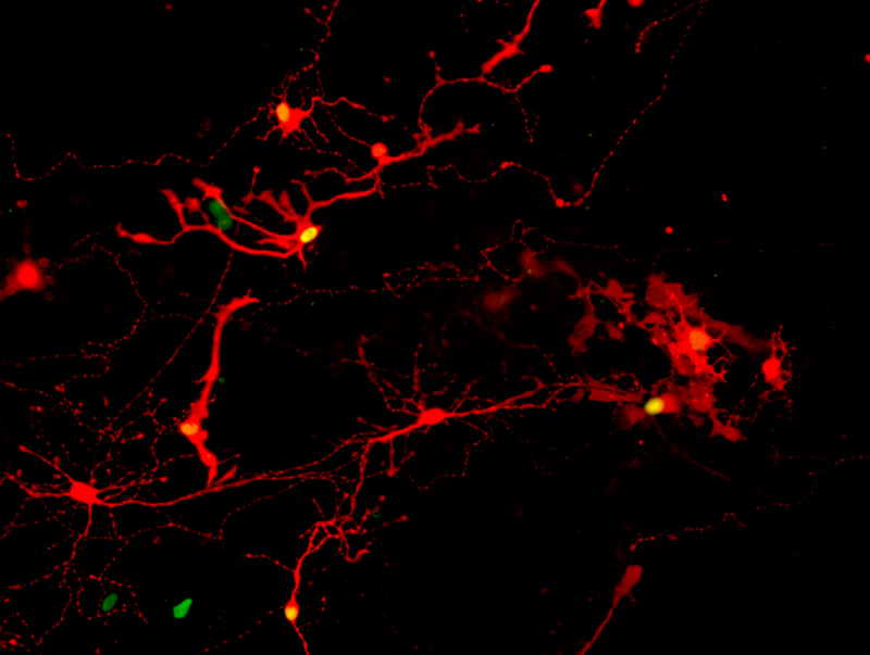 Retinal neurons glowing red, some with green nuclei Retinal neurons glowing red, some with green nuclei