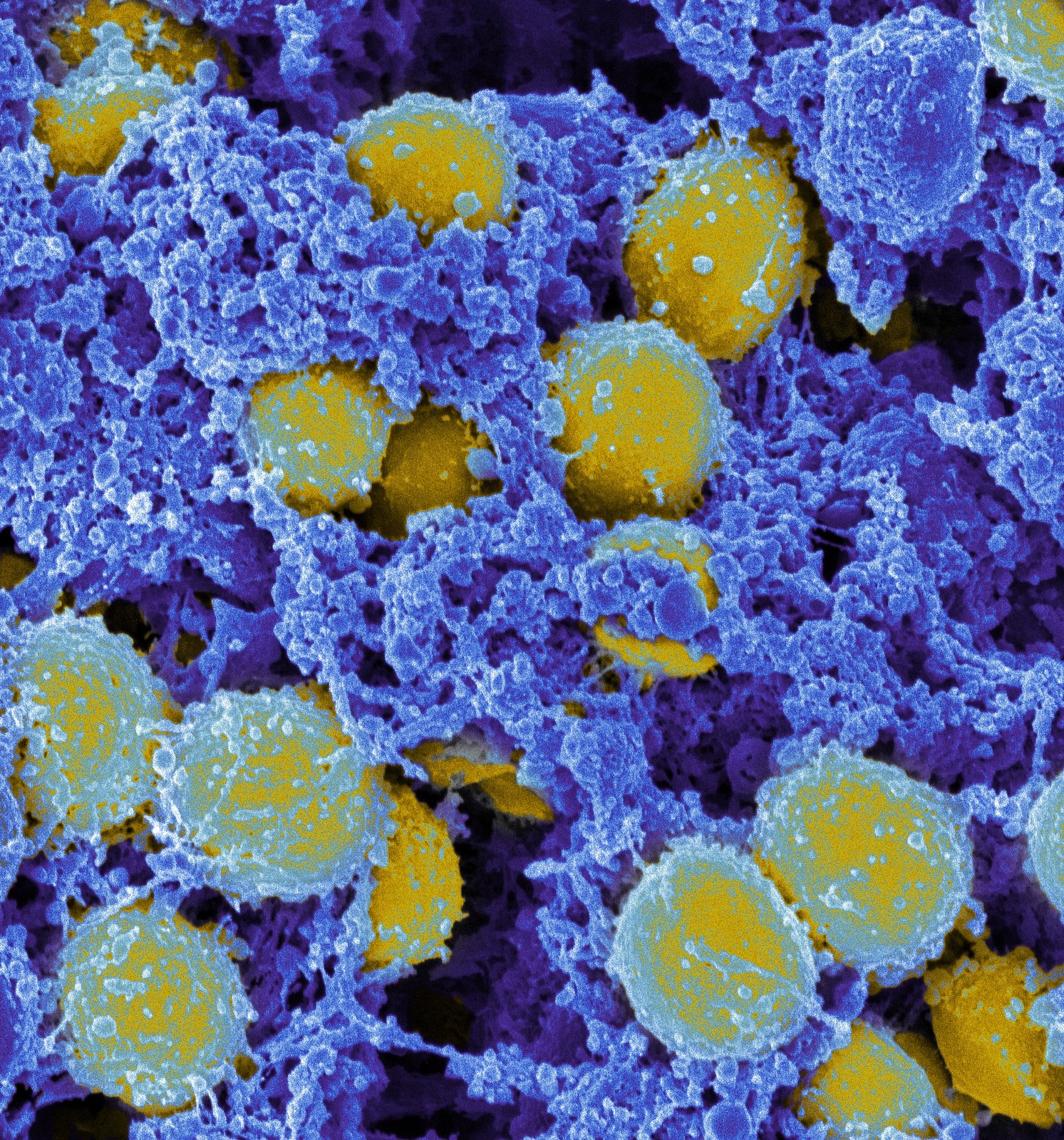 Staphylococcus aureus, bacterium