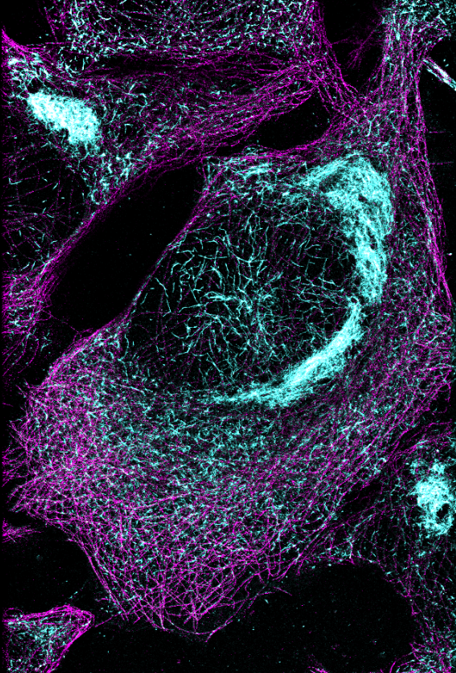 Microscope image of a cell with blue clumping throughout.