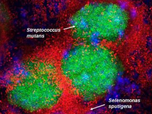 Streptococcus mutans in green filling the gaps in the structure. Streptococcus mutans in green filling the gaps in the structure.
