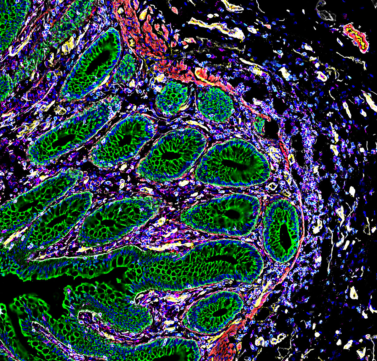 Cross section of human intestinal cells. Cross section of human intestinal cells.