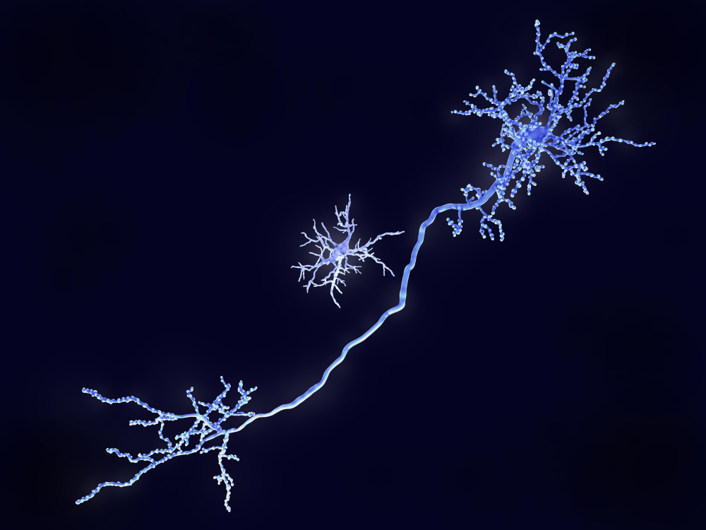 Microglial cell near the long stalk of a neuron.