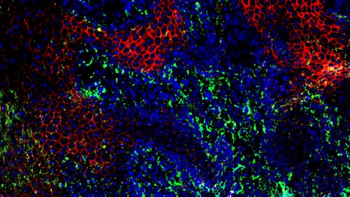 Immunofluorescence image with an area of disordered cells. Immunofluorescence image with an area of disordered cells.
