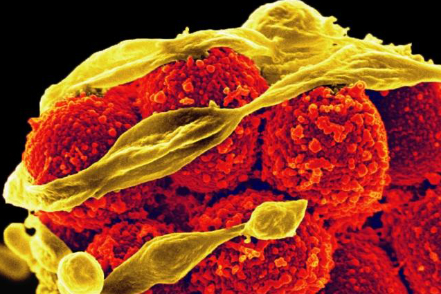 Methicillin-resistant Staphylococcus aureus bacteria Methicillin-resistant Staphylococcus aureus bacteria