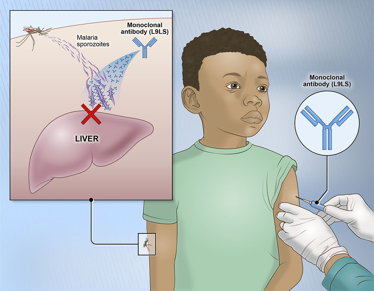 Illustration shows injection of the monoclonal antibody into one arm of a child with a closeup of a mosquito biting his other arm and the antibody neutralizing the malaria sporozoites before they reach the liver.
