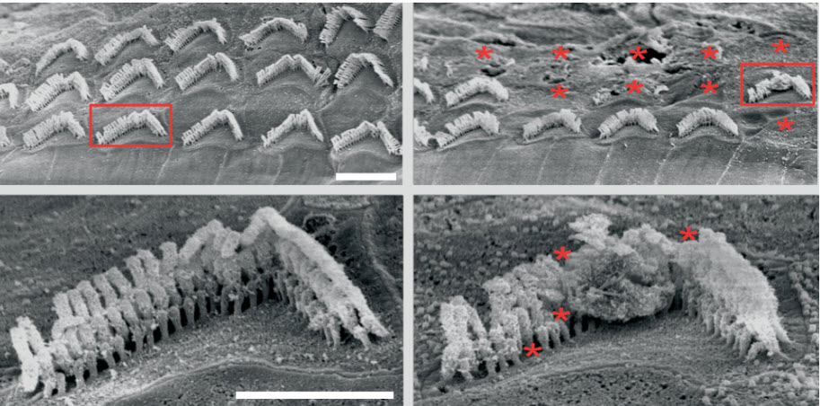 Scanning electron micrograph images of mouse inner ear hair cells. Scanning electron micrograph images show straight rows of hair-like structures in treated ears and disorganized ones in untreated ears.