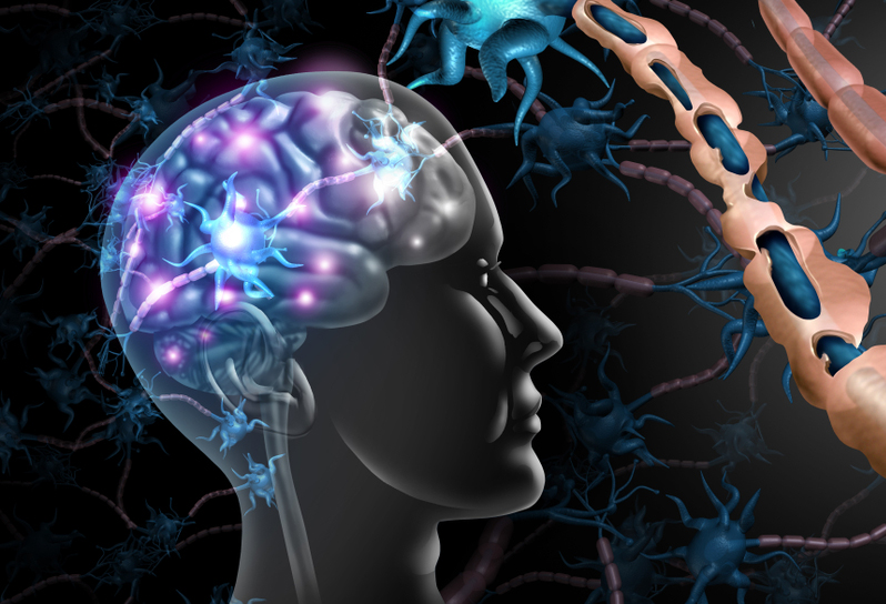 Illustration showing a brain artistically lit up from an immune attack and a close-up of damaged myelin around a nerve. Illustration showing a brain artistically lit up from an immune attack and a close-up of damaged myelin around a nerve.