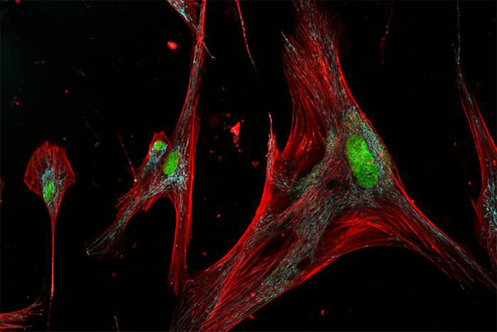 Microscope image of long cells with visible fibers inside. Microscope image of long cells with visible fibers inside.