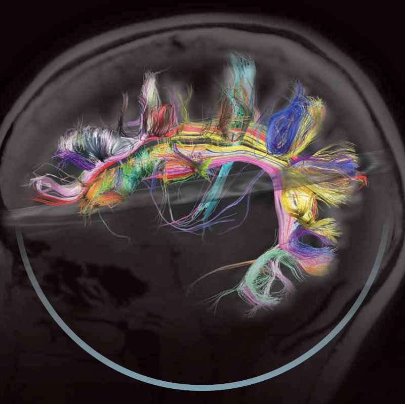 Map of the wiring diagram of specific brain circuits, now called the 'connectome' in the human brain.