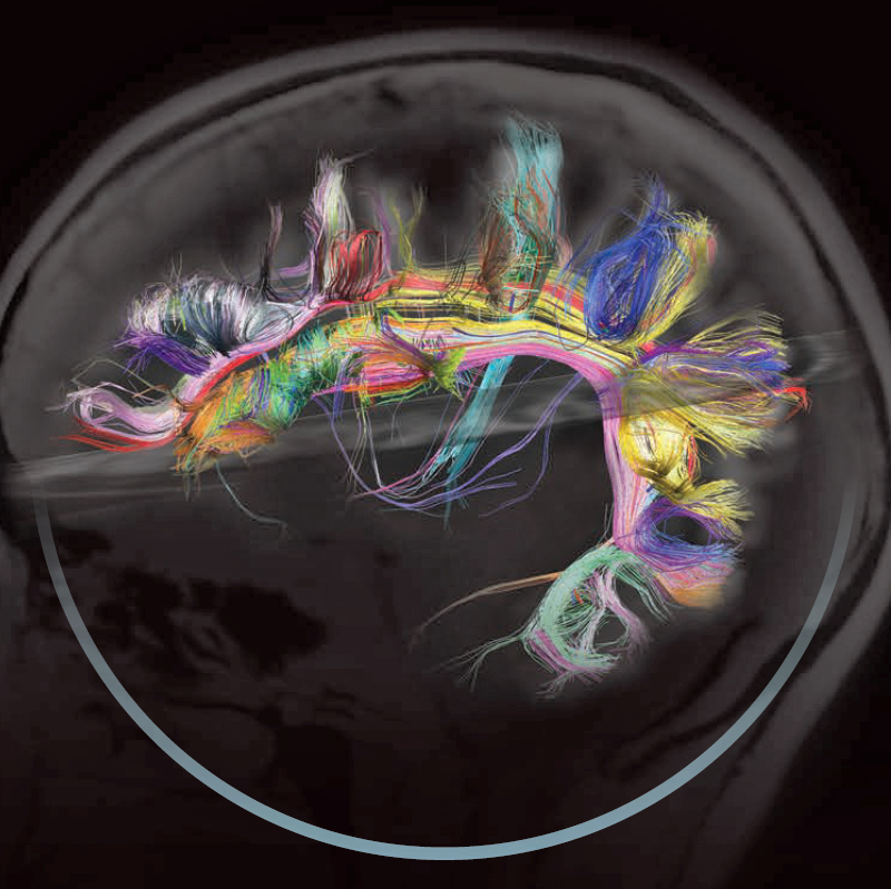 Brain connectome Map of the wiring diagram of specific brain circuits, now called the 'connectome' in the human brain.