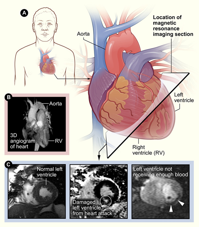 3 panel image showing different methods of viewing the heart.