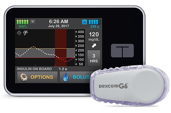Continuous glucose monitor and insulin pump.