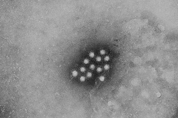 Transmission electron micrograph of a small cluster of the ribonucleic acid (RNA) hepatitis A virus (HAV).