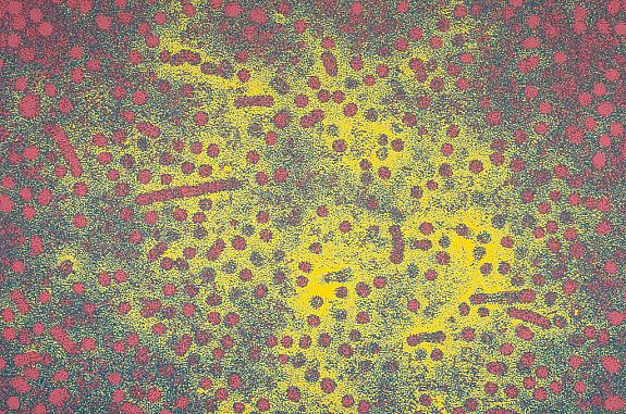 Electron microscope image of the hepatitis B virus (HBV).