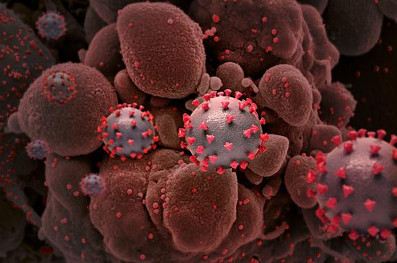 Creative rendition of SARS-COV-2 virus particles.
