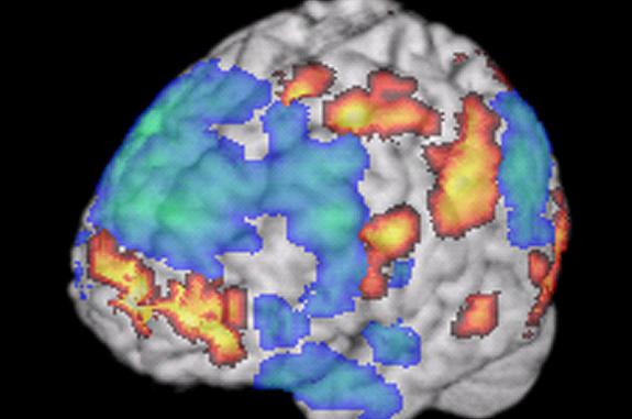 Brain image from a functional MRI scan when a person was listening to improvised jazz music.