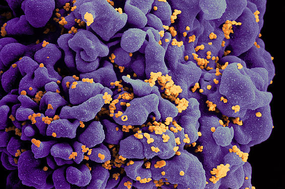T cell covered with numerous virus particles