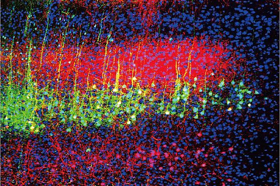 Neurons in a mouse brain’s auditory cortex