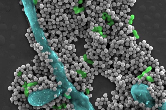 Scanning electron micrograph shows dozens of tiny gray magnetic spheres alongside common oral microbes.