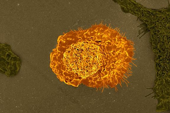 Colorized scanning electron micrograph of a macrophage. 