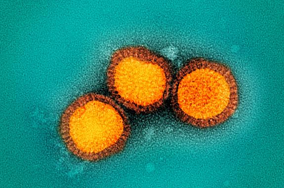 Colorized electron micrograph of three round virus particles