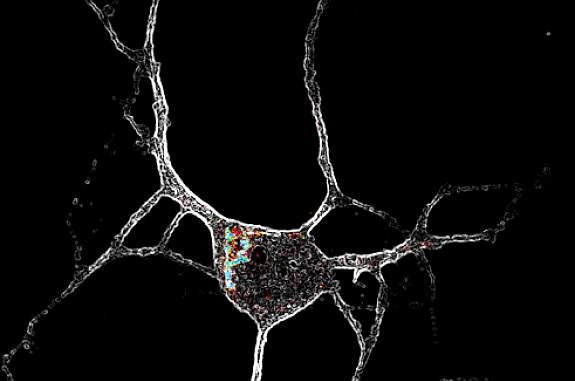 Neuron with 5-HT2A receptors inside