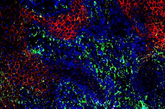 Immunofluorescence image with an area of disordered cells.
