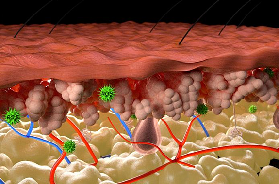 Illustration of inflamed skin shows layers affected by reactive oxygen species.