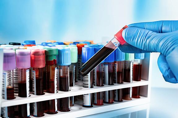 Gloved hand holding a test tube with a blood sample.