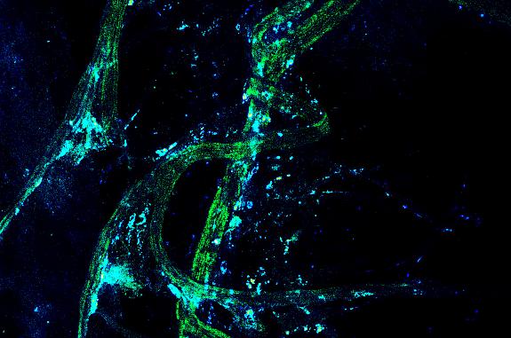 Confocal microscopy image shows Treg cells clustered next to long nerve cells.