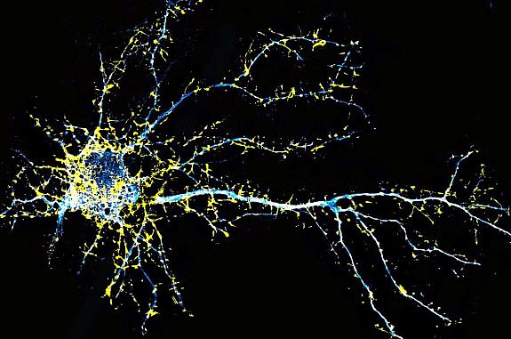 Fluorescence microscopy image of a cortical neuron.