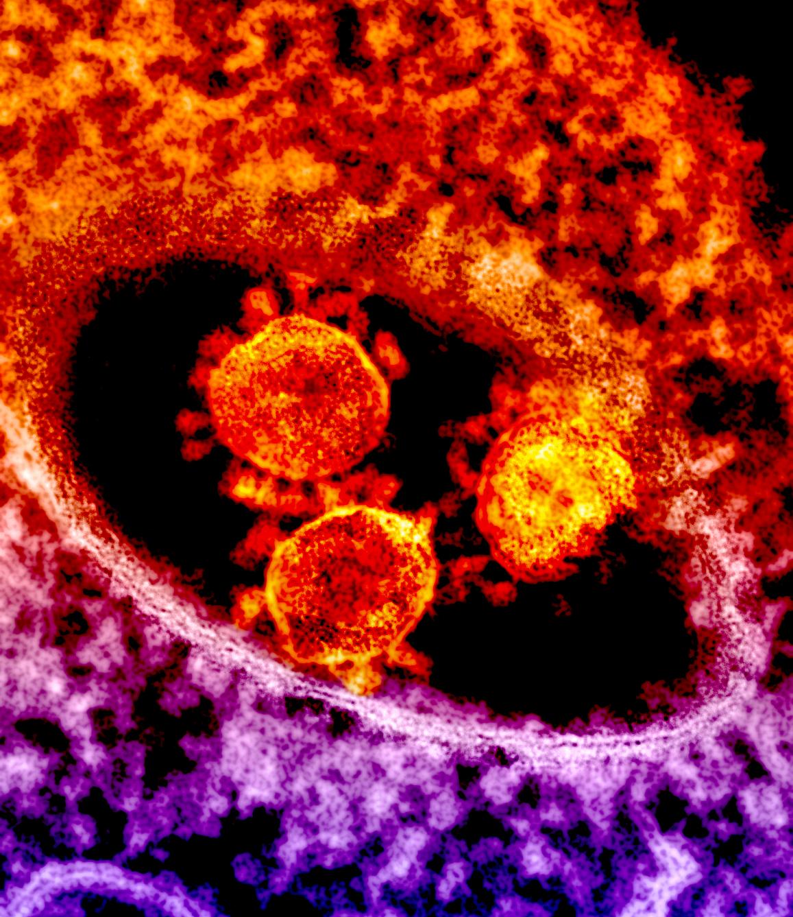 MERS Antibodies Produced in Cattle Safe, Treatment Well Tolerated in Phase 1 Trial