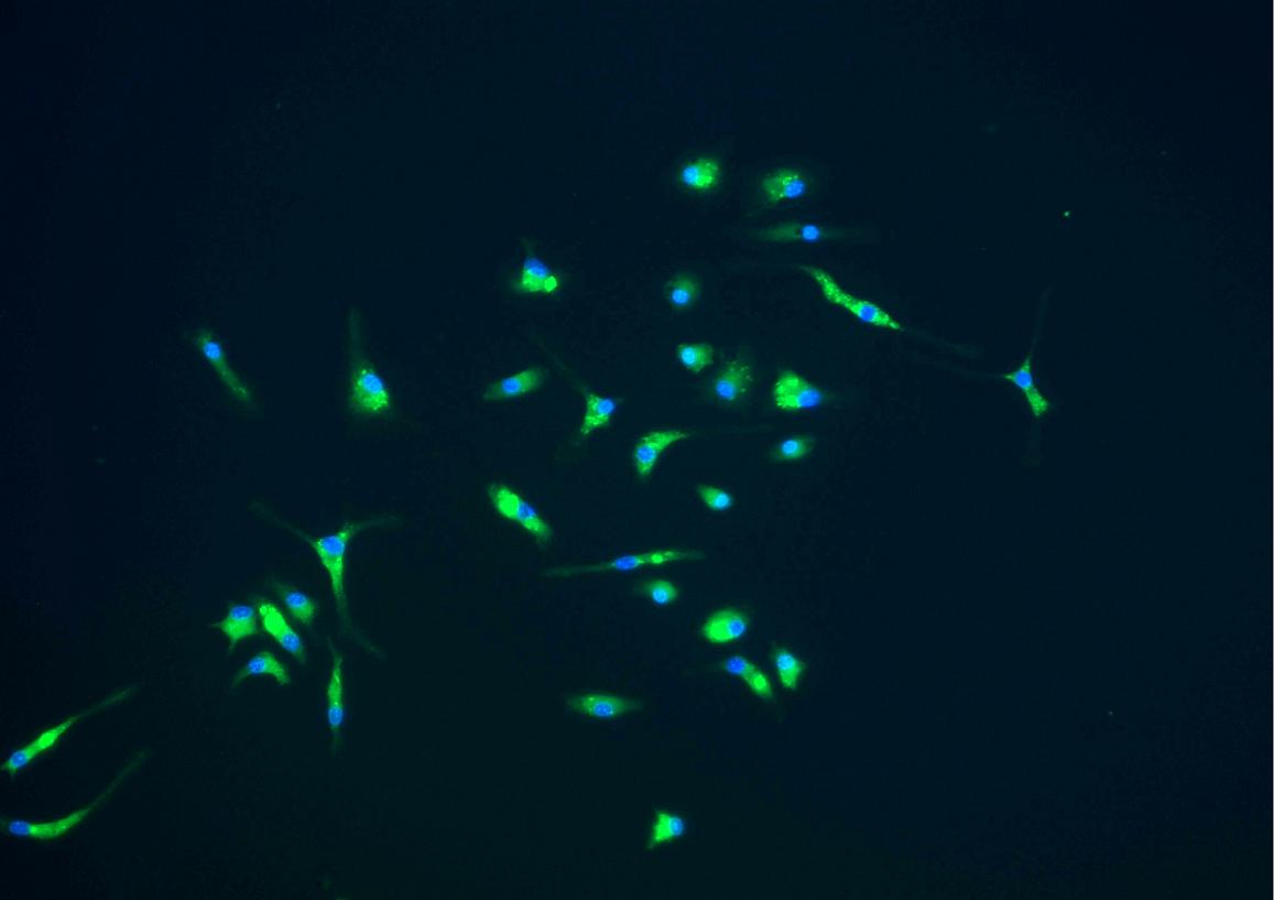 Microglia Are Key Defenders Against Prion Diseases
