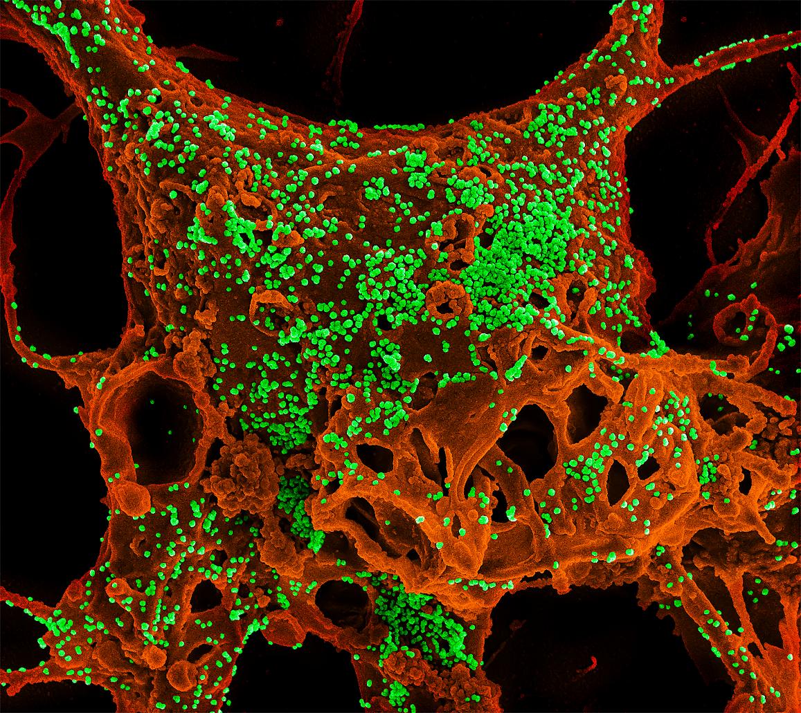 MERS coronavirus